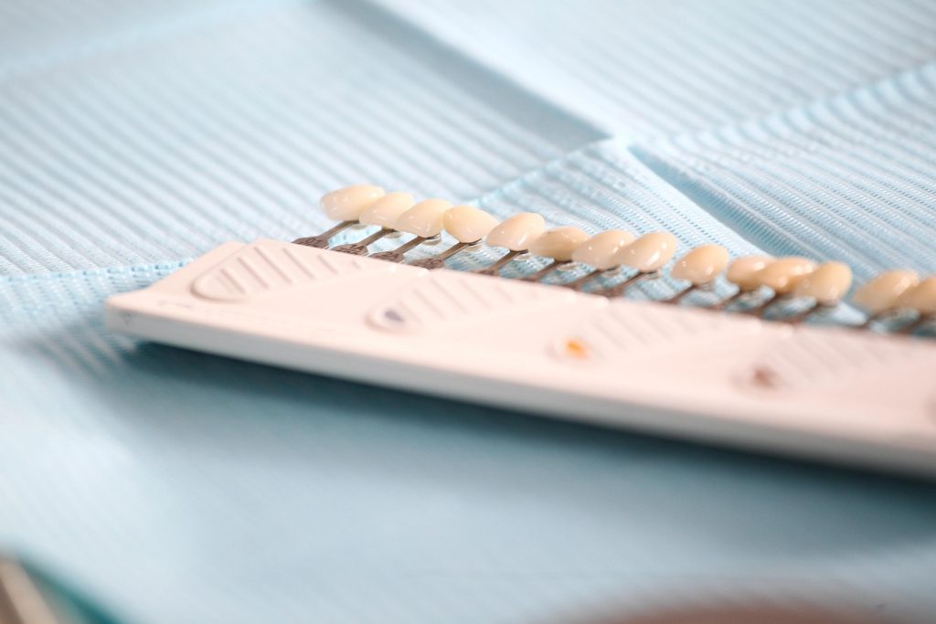 Hacerse un blanqueamiento dental profesional en una clínica dental en Roquetas de Mar o Aguadulce