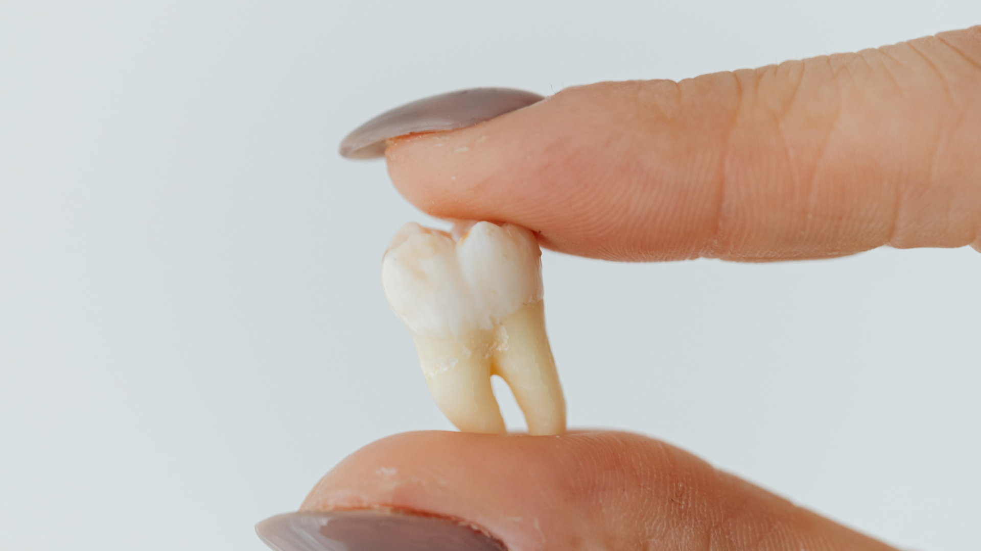 Enfermedades que afectan los dientes | Dental Estetic